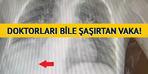 Sürekli hastaneye kaldırıldı, gerçek 3 yıl sonra ortaya çıktı